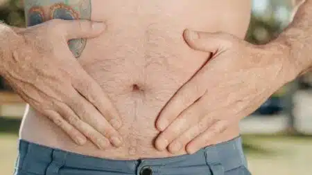 abdominal bloating